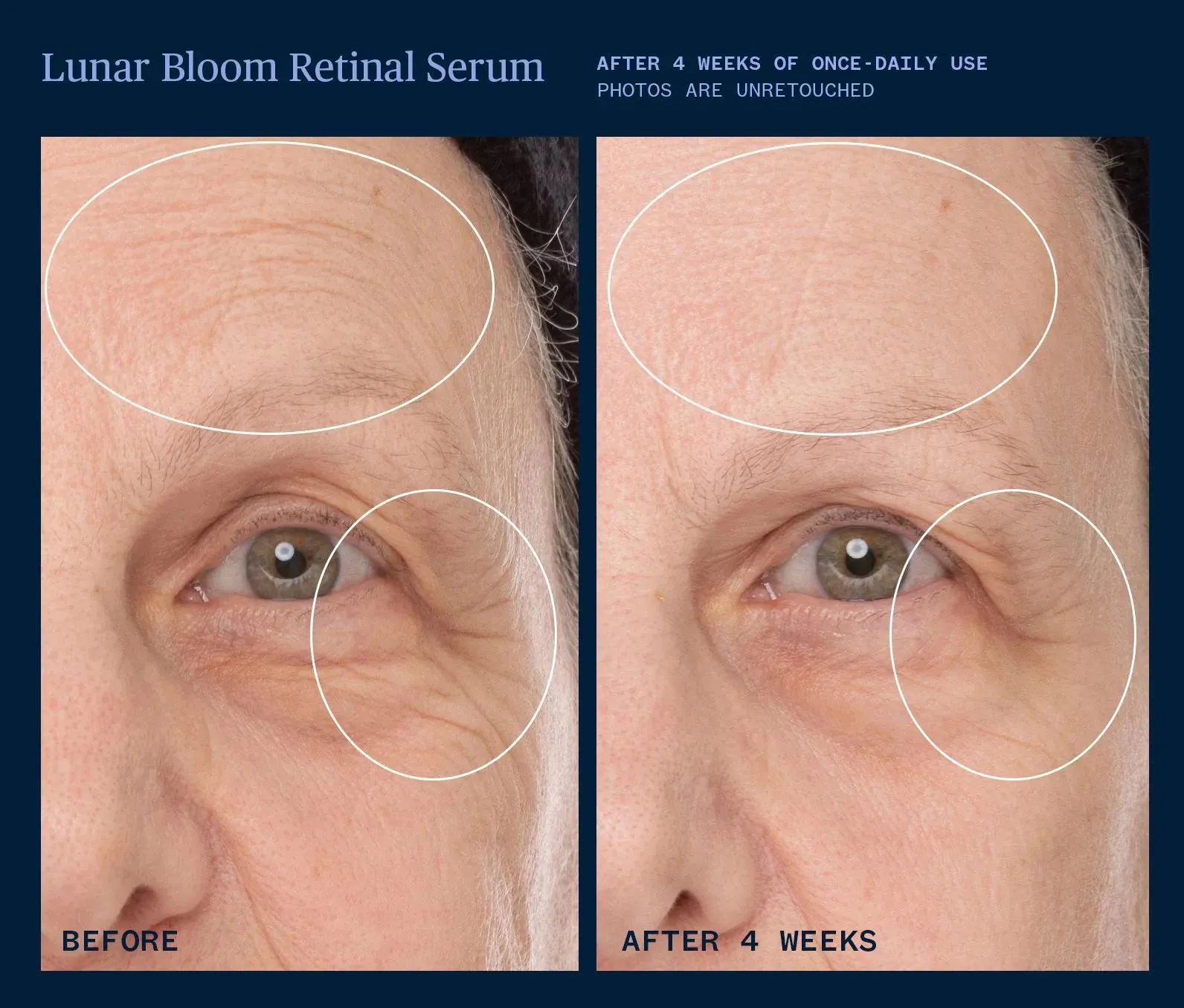 Lunar Bloom Retinal Serum